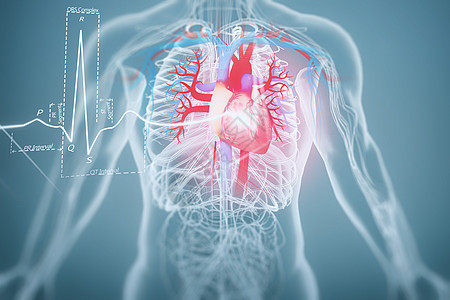 心脏病血栓形成高清图片