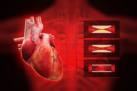心脏病背景图片