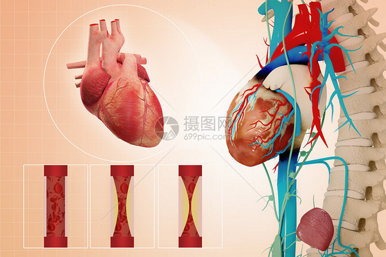 心脏疾病图片