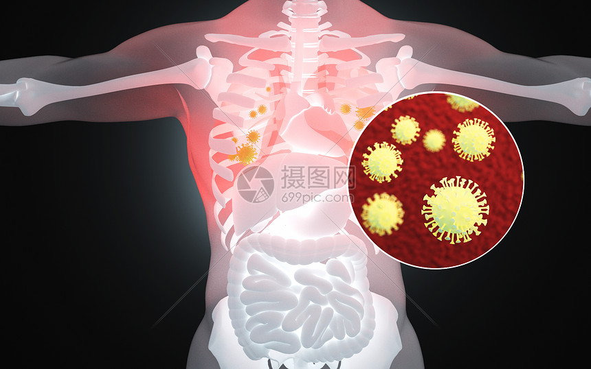人体肺部病毒病变图片