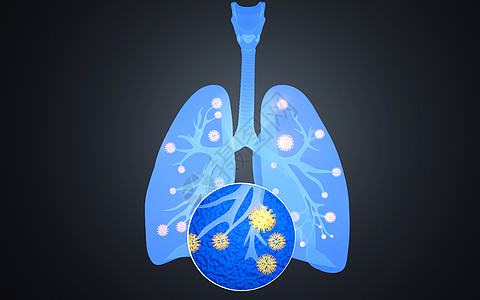 肺部疾病X光片背景图片