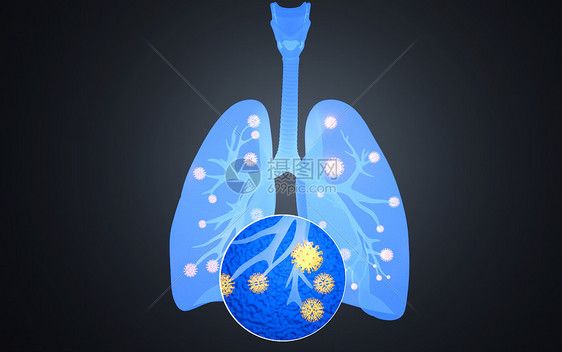肺部疾病X光片图片