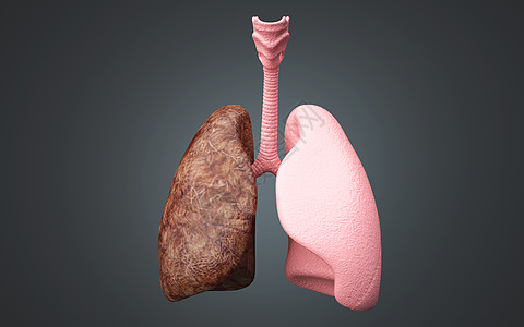 肺部疾病图片