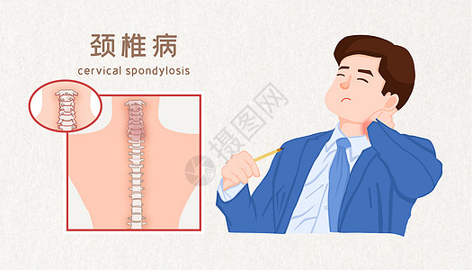 颈椎病医疗插画高清图片