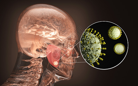 腮腺疾病人体腮腺感染设计图片