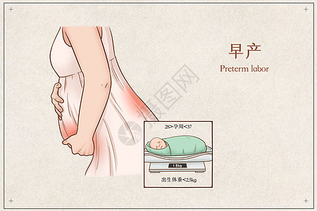 早产医疗插画图片