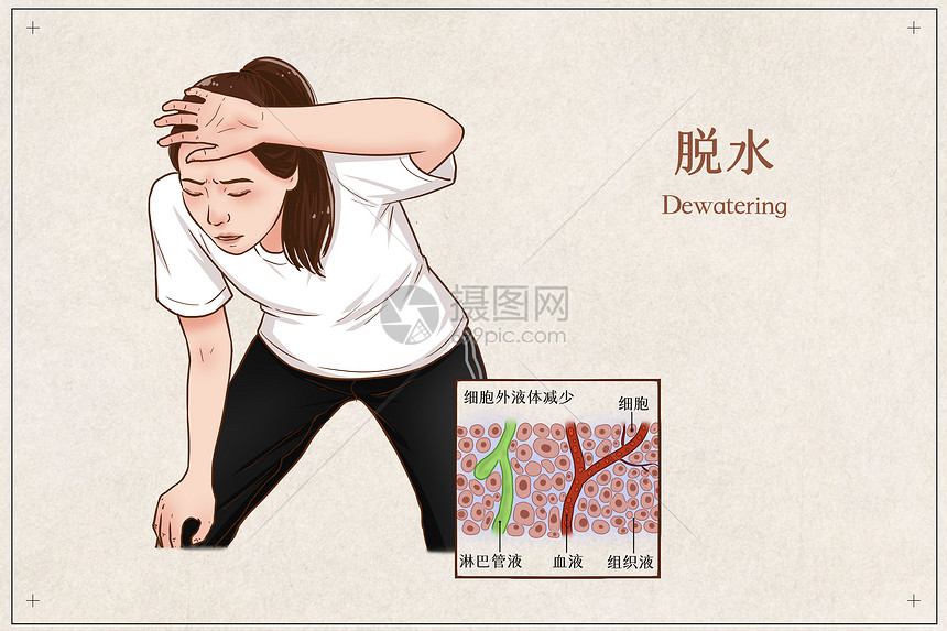 脱水医疗插画