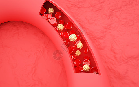 脂肪肝血液杂质设计图片