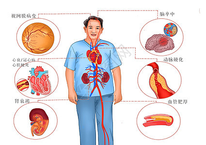 高血压主要危害医疗插画图片