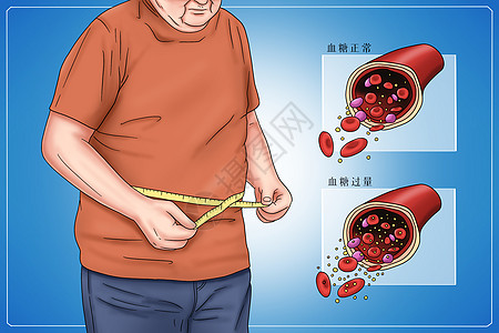 糖尿病类型2型糖尿病医疗插画图片