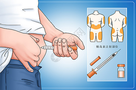 糖尿病胰岛素治疗医疗插画图片