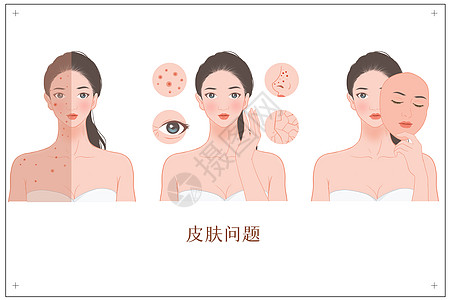 护肤品画册女性各种皮肤问题插画