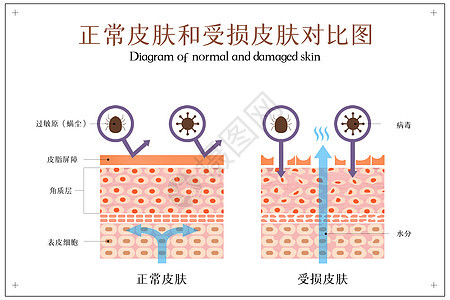 正常皮肤和受损皮肤对比示意图背景图片