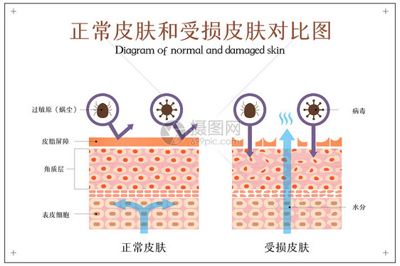 正常皮肤和受损皮肤对比示意图图片