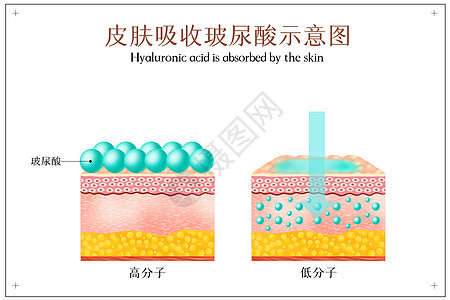 美容 脸部皮肤吸收玻尿酸示意图插画