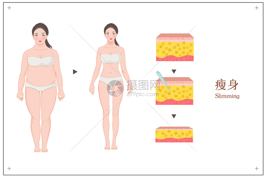 女性抽指瘦身对比图医美插图图片