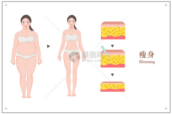 女性抽指瘦身对比图医美插图图片