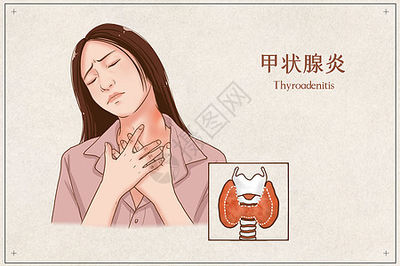 甲状腺炎医疗插画图片