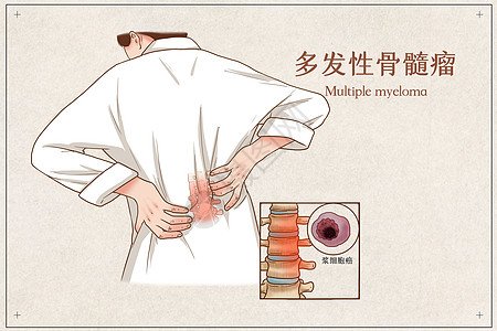 颌骨癌插画_颌骨癌卡通_颌骨癌插图_手绘_板绘_摄图网