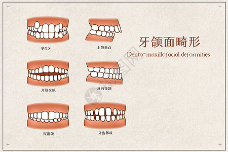 牙齿牙颌面畸形医疗插画插画