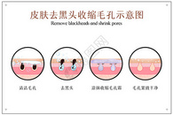 去黑头收缩毛孔皮肤护理示意图图片