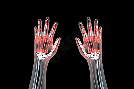 手骨图片 手骨素材 手骨高清图片 摄图网图片下载 手骨图片 手骨素材 手骨高清图片 摄图网图片下载