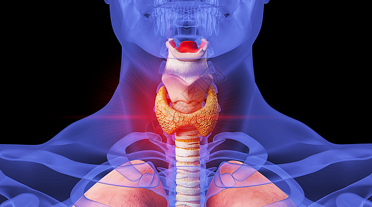 甲状腺人体甲亢场景设计图片