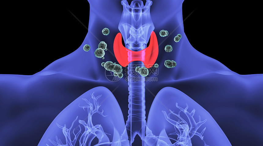 人体甲亢场景图片