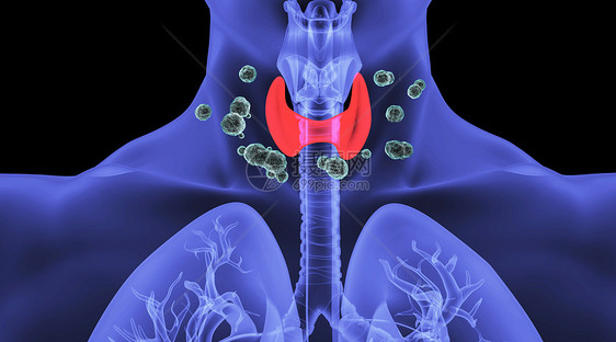 人体甲亢场景图片