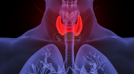 人体甲亢场景图片