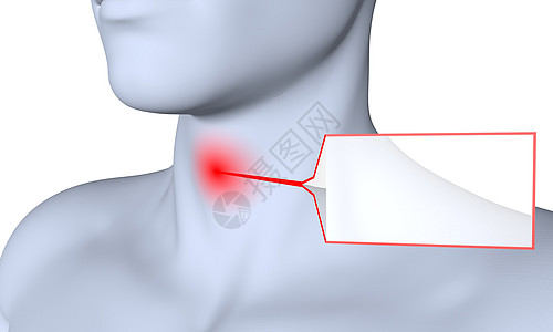 咽喉肿痛背景图片
