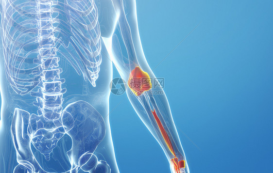 人体手臂骨质增生图片