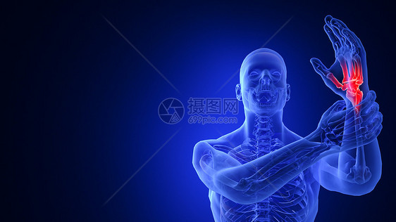 C4D腕关节疾病图片