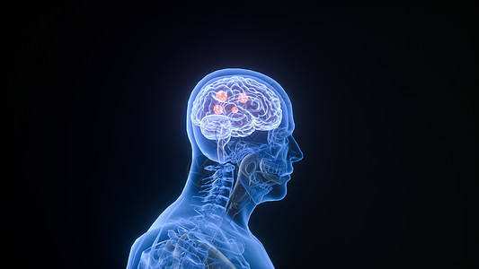 癌图片_癌素材_癌高清图片_摄图网图片下载