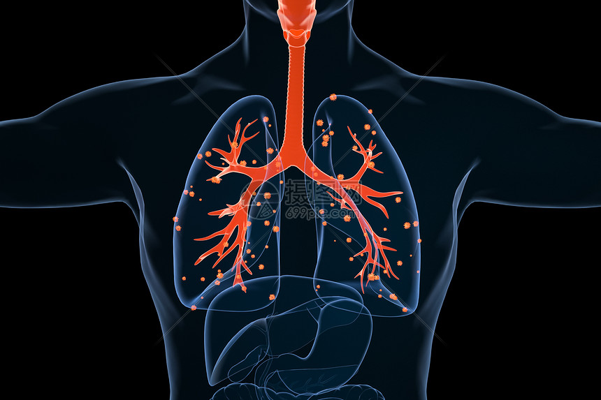肺部病变场景图片