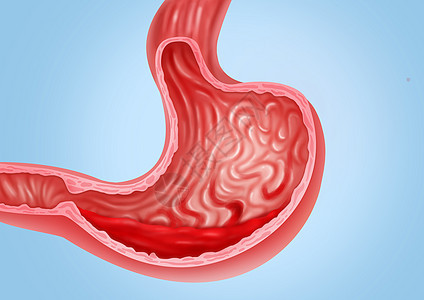 胃出血医疗健康插图图片
