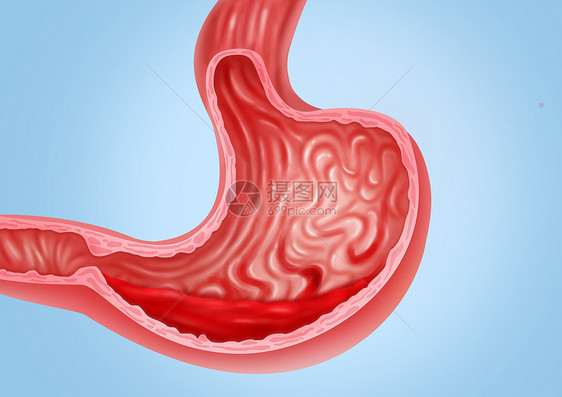 胃出血医疗健康插图图片