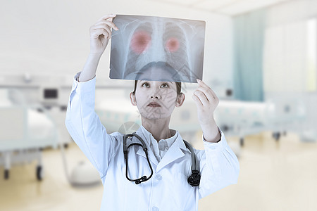 x光照片肺癌设计图片