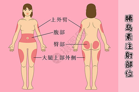 糖尿病患者胰岛素注射部位图片