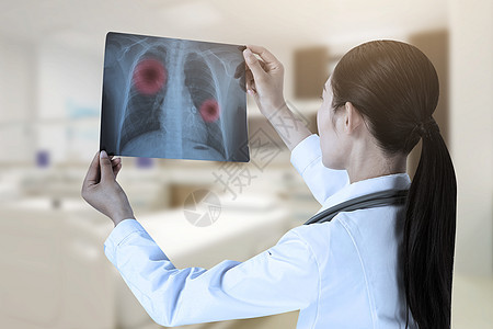 肺癌图片