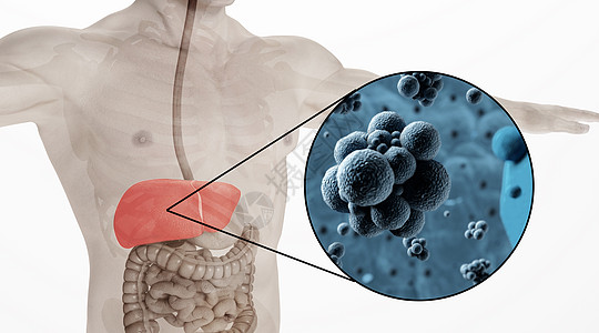 糖脂和蛋白质立体人体乙肝场景设计图片