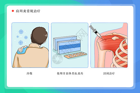 肩周炎常规治疗医疗插画高清图片