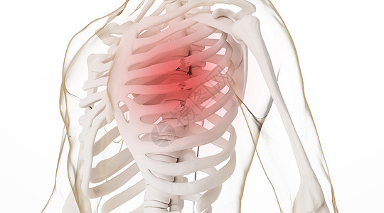 胸部肋骨骨折场景设计图片