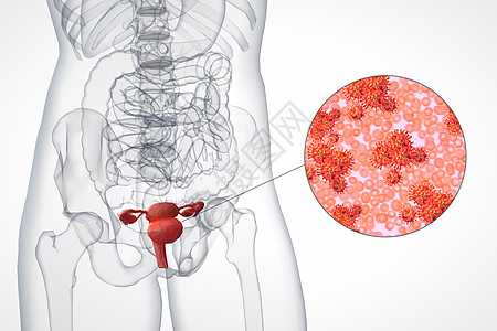 阴道细菌膀胱细菌场景设计图片