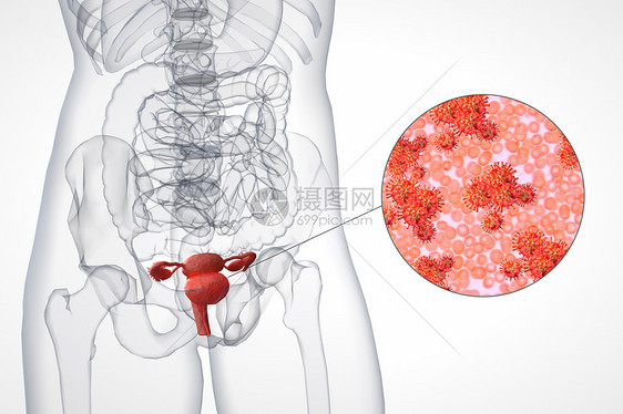 膀胱细菌场景图片