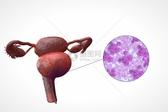 阴道细菌感染图片