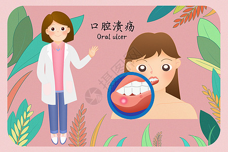 口腔溃疡医疗插画图片