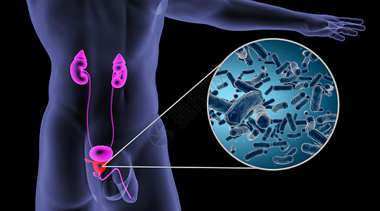 尿频人体前列腺感染场景设计图片