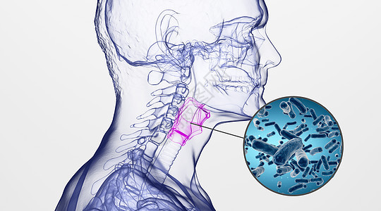 人体咽喉炎场景图片