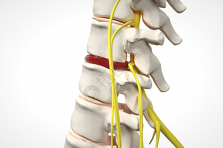 脊柱组织腰椎局部骨架突出场景设计图片